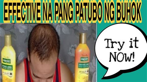 mabisang pampatubo ng buhok sa ulo